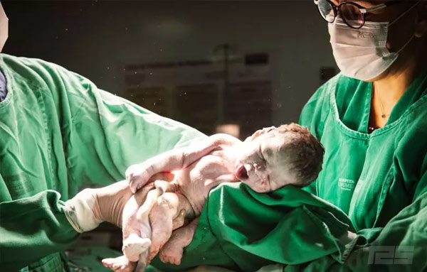 Ácidos graxos presentes do cordão umbilical poderão ser causa do autismo, evidencia estudo acidos-graxos-presentes-do-cordao-umbilical-podem-ser-causa-do-autismo,-revela-estudo
