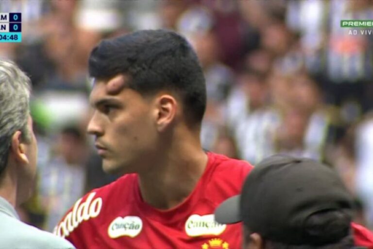 Santos atualiza quadro do goleiro Gabriel Brazão. Dê uma olhada santos-atualiza-quadro-do-goleiro-gabriel-brazao.-confira